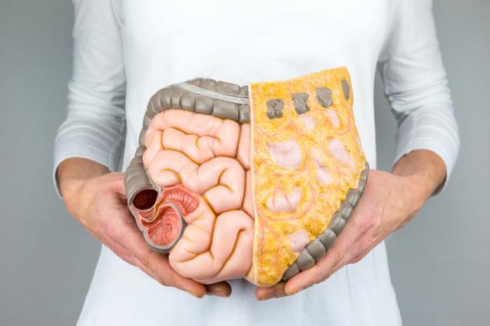 woman holding model of intestines in front of her 696x463 - افزودنی های غذایی  و تاثیر آن بر باکتری های روده