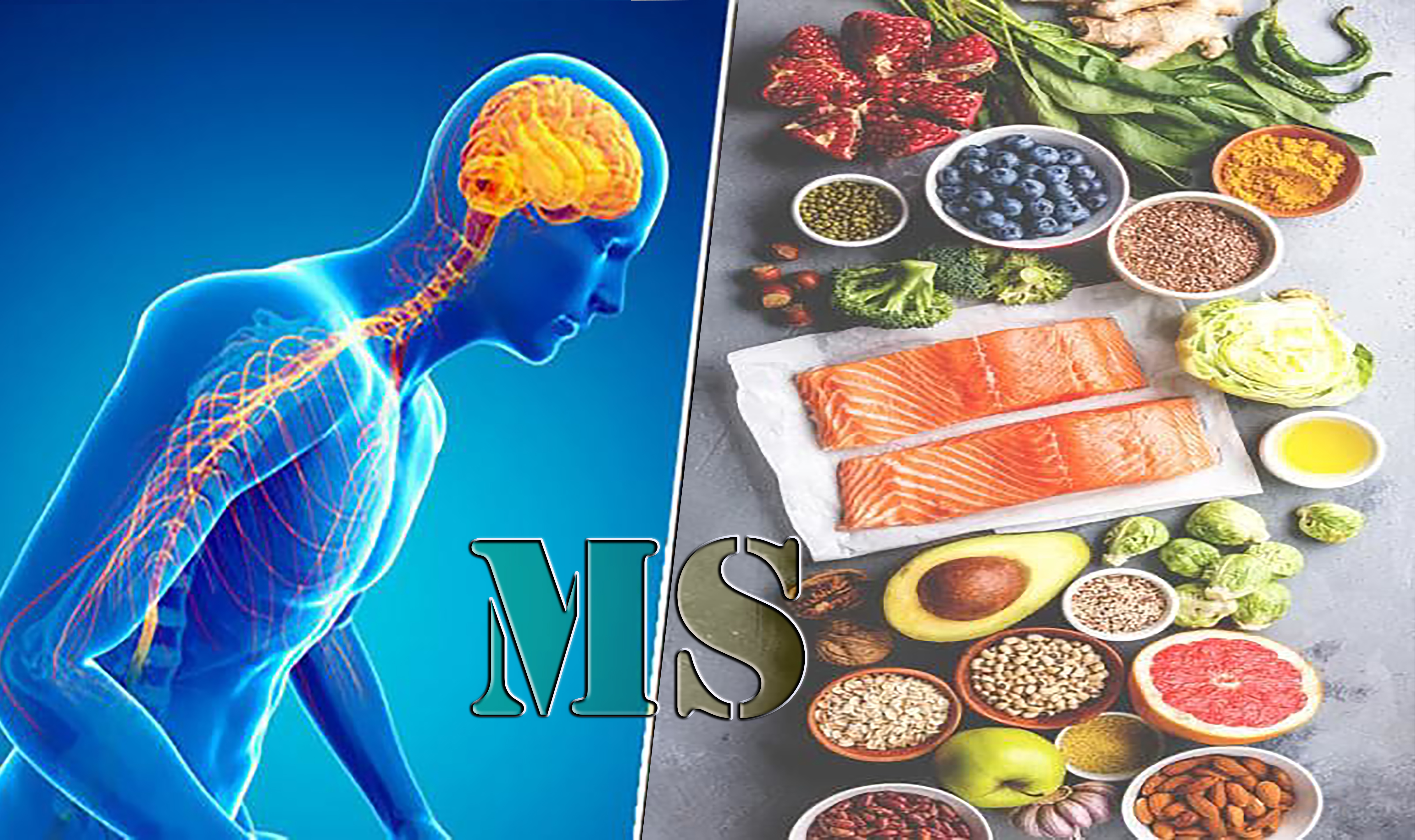MS food - خواص کاکائو برای مبتلایان به بیماری ام اس (MS)