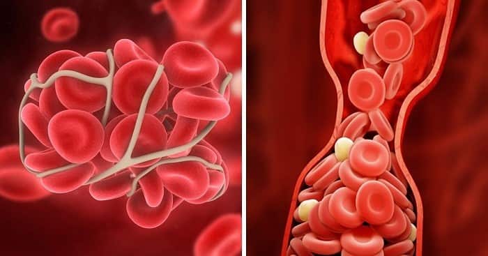 از لخته شدن خون با تغذیه، ورزش و دارو ممکن است؟ min - نوشیدنی که از لخته شدن خون جلوگیری می کند